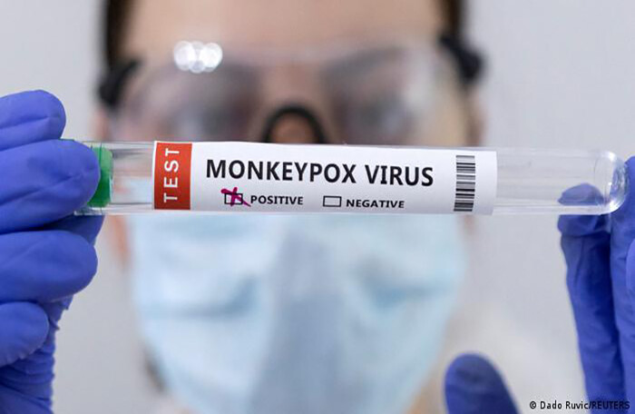 Ghi nhận gần 7.000 ca bệnh, Mỹ tuyên bố đậu mùa khỉ là tình trạng khẩn cấp về sức khoẻ