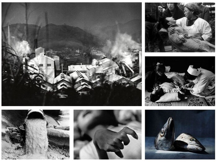 Thảm họa 'vịnh thủy ngân' và bệnh lạ khủng khiếp nhất lịch sử Nhật Bản