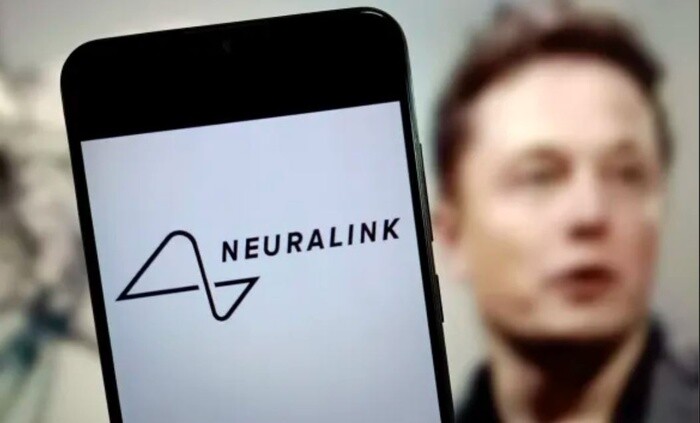 Bệnh nhân được tỷ phú Elon Musk cấy chip não có thể điều khiển chuột máy tính bằng suy nghĩ